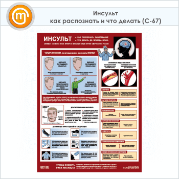 Плакат «Инсульт - как распознать и что делать» (С-67, ламинированная бумага, А2, 1 лист)