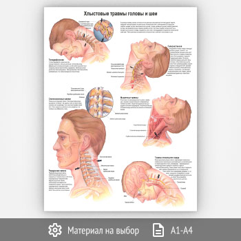 Плакат «Хлыстовые травмы головы и шеи» (ЗОЖ-44, 1 лист)
